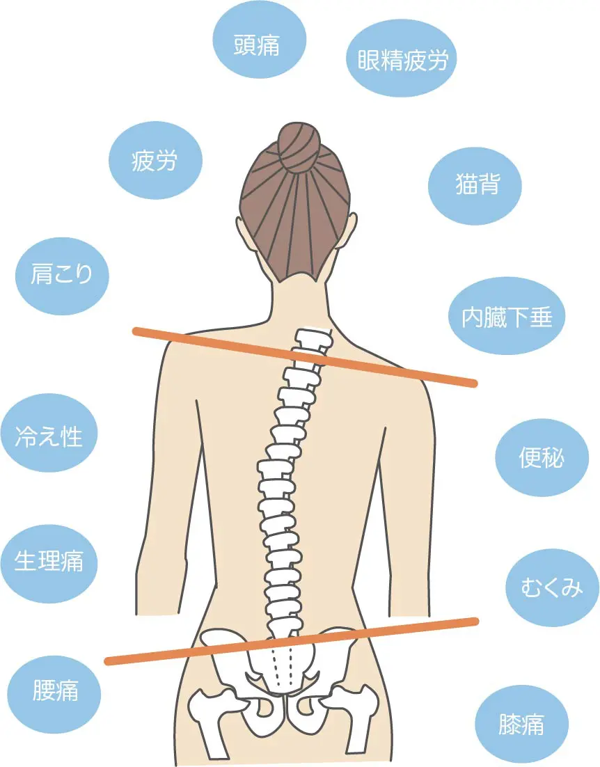 骨盤の歪みの改善なら | 姿勢本著者が院長｜三鷹の整体・カイロ